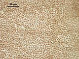 6 – Cellule corticali in visione superficiale